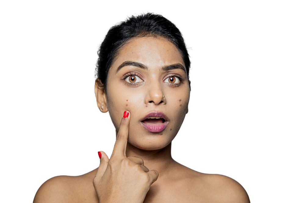 Natural Scar Treatment and Skin Healing at Vydyans Skin Clinic Scar reduction and skin rejuvenation therapy at Vydyans Ayurveda Clinic in Vylathur, Thrissur, Kerala