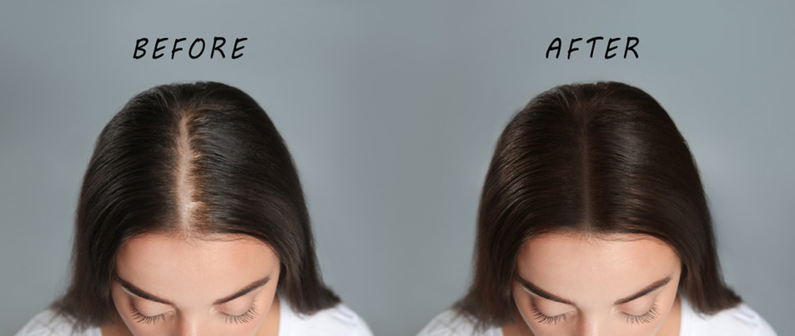 Skin and Hair Solutions by Dr. Femina Treatment for skin problems and hair loss at Vydyans Ayurveda Skin & Hair Clinic
